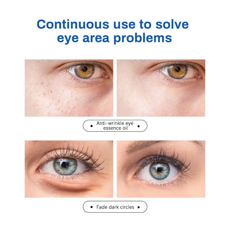 Eye Essence Oil Factory - MULAN Anti Aging Remove Dark Circles