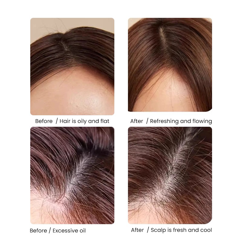 Anti Dandruff Shampoo Factory - MULAN Organic Gel Form Salon Use