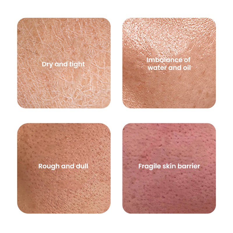 Night Face Cream Manufacturer - MULAN Custom Whitening Acne Anti Wrinkle