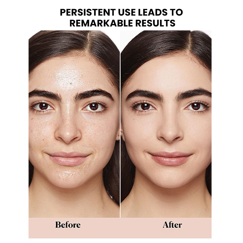 Repair Face Cream Manufacturer - MULAN Hyaluronic Acid Herbal Glycerin