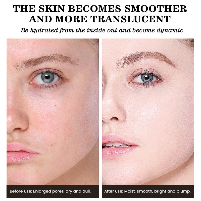 Skin Care Set Factory - MULAN Custom Acne Treatment Korean Style