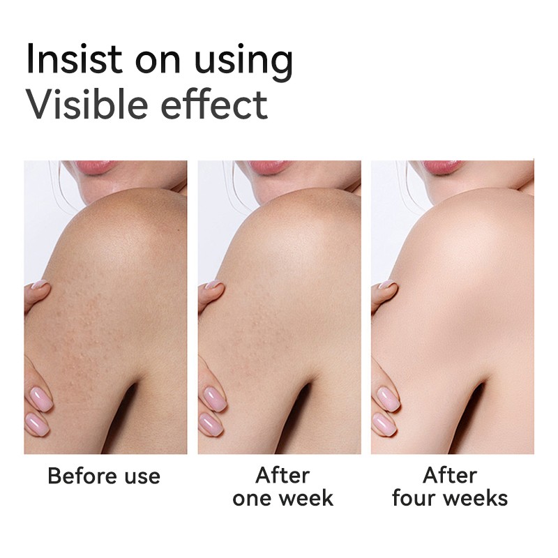 Body Essence Oil Manufacturer - MULAN Natural Rose Vitamin E Nourishing