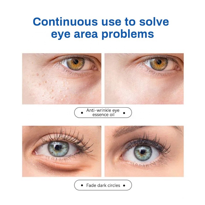 Eye Essence Oil Manufacturer - MULAN Organic Prickly Pear Anti Aging