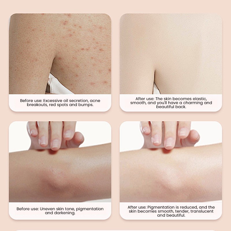 Body Wash Factory - MULAN Organic Acne Fighting Dual Chamber