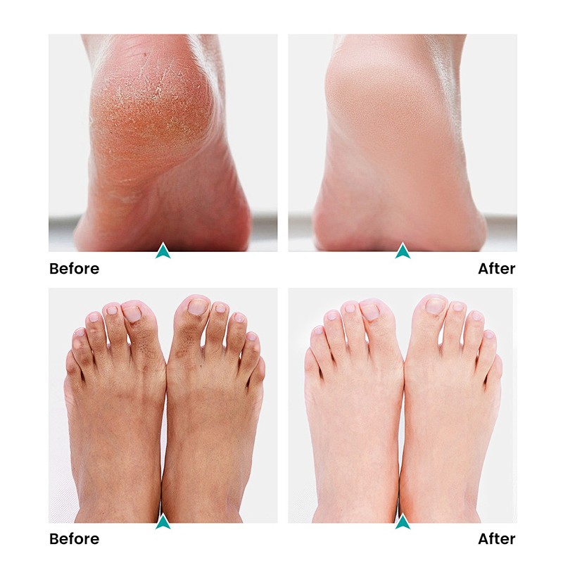 Foot Scrub Factory - MULAN Exfoliating Cream Pedicure Callus Dissolving