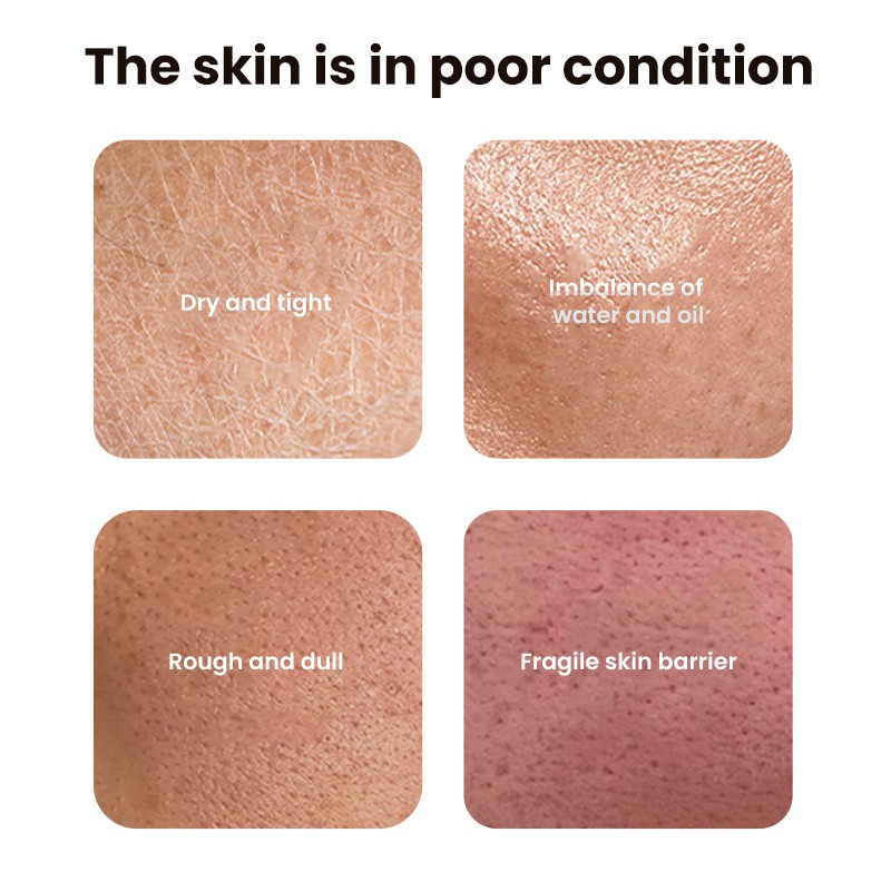 Facial Toner Factory - MULAN Brightening Nourishing Soothes Skin