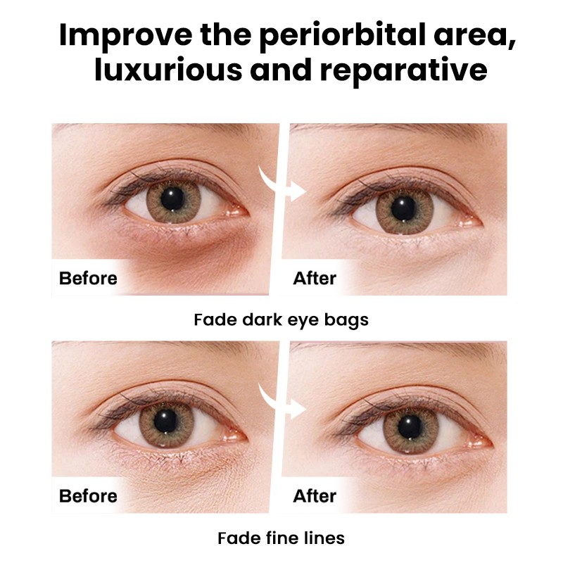 Eye Spa Manufacturer - MULAN Customizable Peptide Whitening Moisturizer