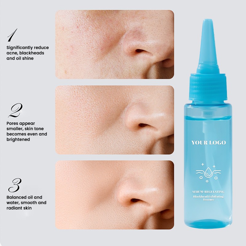 Blackhead Essence Manufacturer - MULAN Private Label Exfoliating Oil