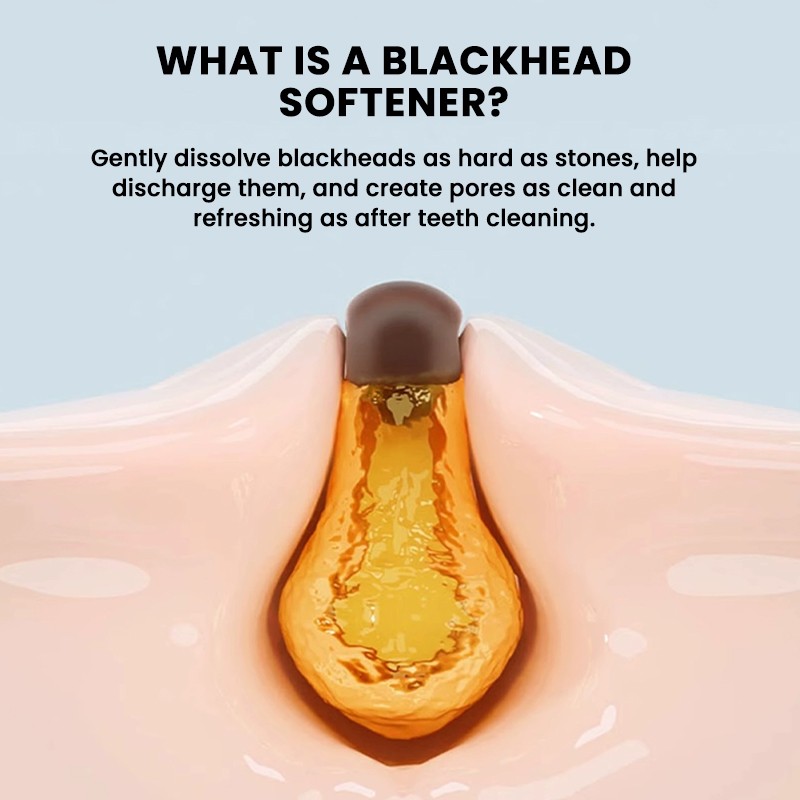 Blackhead Essence Manufacturer - MULAN Private Label Exfoliating Oil