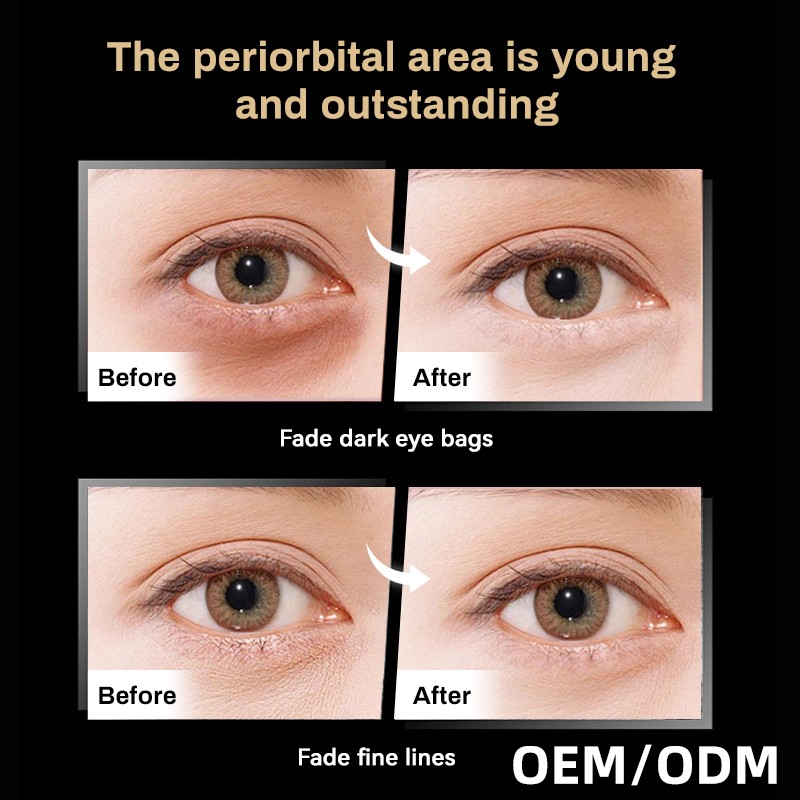 Eye Serum Factory - MULAN High Quality Anti Wrinkle Dark Circles