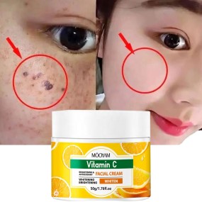 Face Cream Supplier - OEM Azelaic Acid Whitening