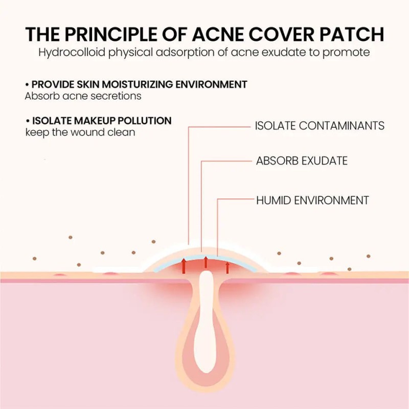 Acne Patch Manufacturer - Bulk Hydrocolloid Invisible