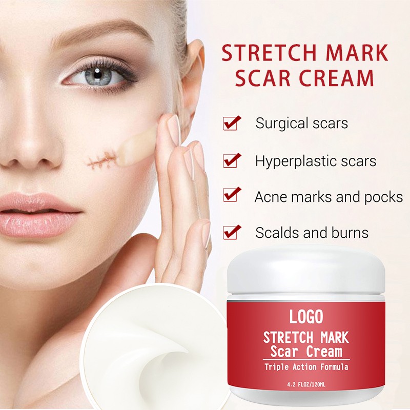 Stretch Mark Cream Factory - OEM 100ML Organic