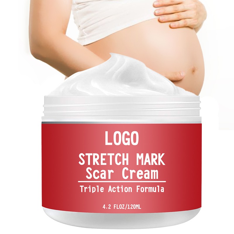 Stretch Mark Cream Factory - OEM 100ML Organic
