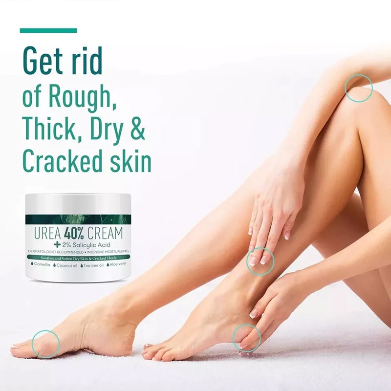 Urea Cream Supplier - Bulk 40% Cracked Heels