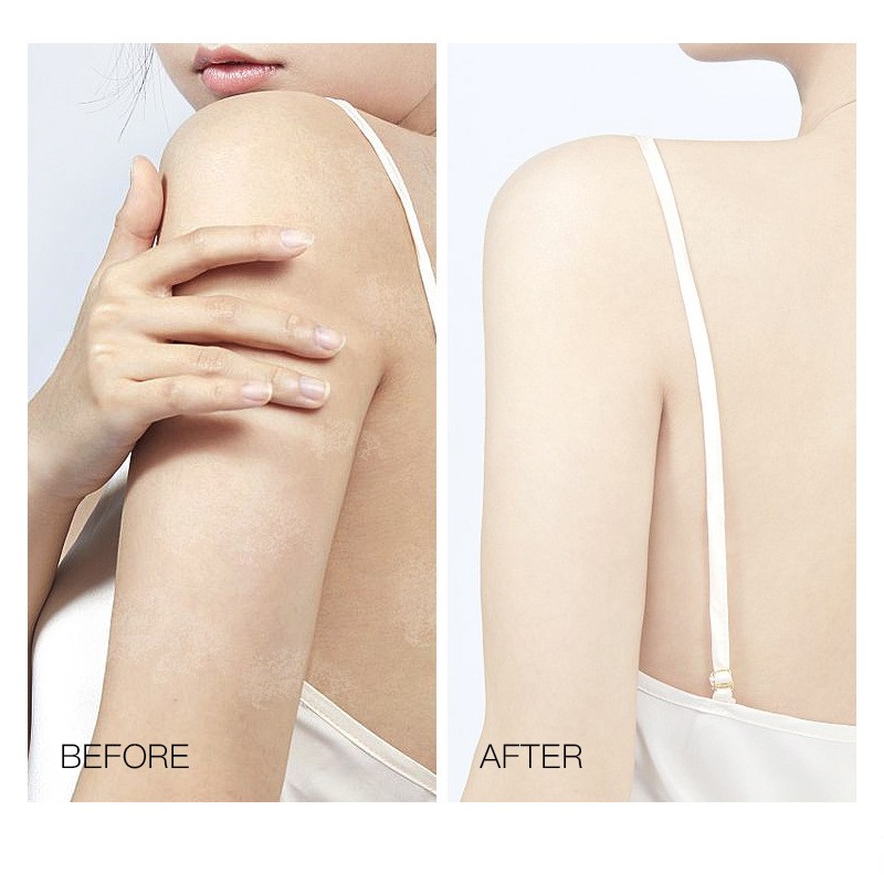 Body Lotion Supplier - Custom Niacinamide Lightening