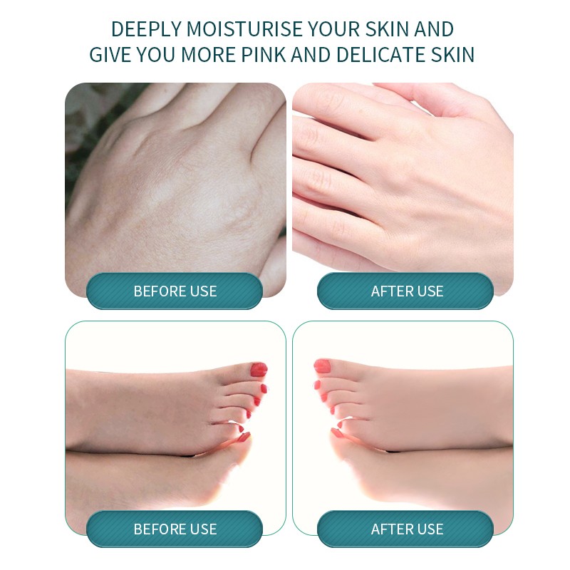 Foot Peel Mask Factory - Custom Nicotinamide Moisturizing