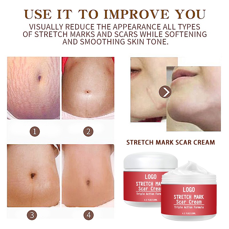 Stretch Mark Cream Factory - OEM 100ML Organic