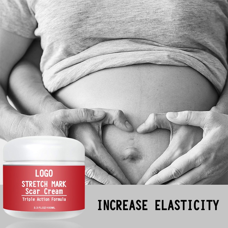 Stretch Mark Cream Factory - OEM 100ML Organic