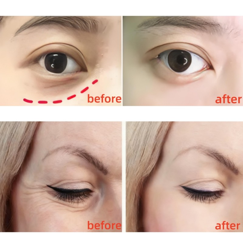 Vitamin C Eye Cream Supplier - OEM Fragrance-Free Sensitive