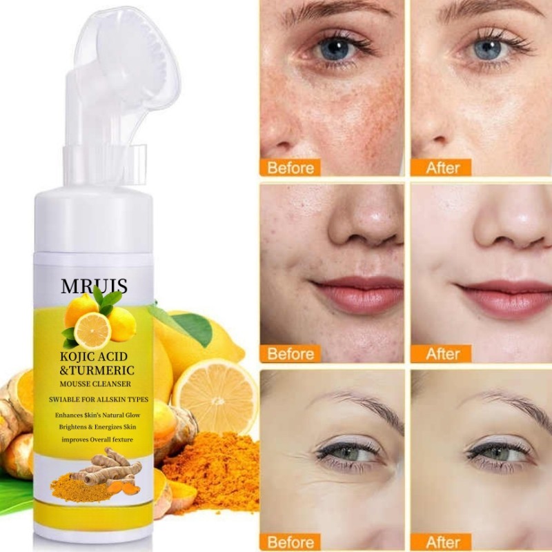 Cleansing Mousse Supplier - OEM Turmeric Kojic Acid