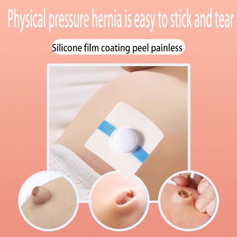 Infant and child umbilical hernia patch  Suitable for sub-healthy individuals suffering from discomfort symptoms such as umbilical hernia, inguinal hernia, and incisional hernia.