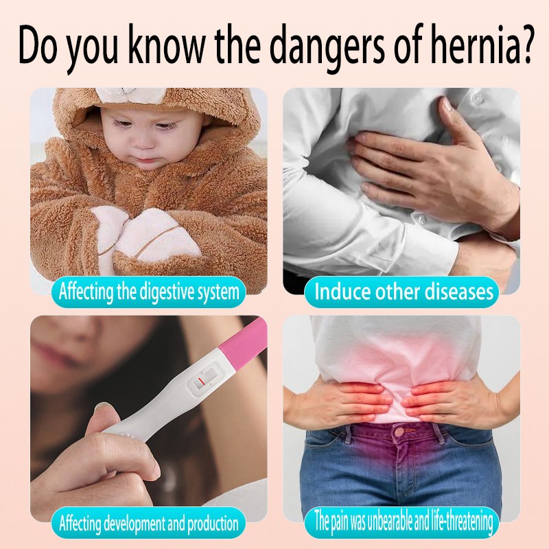 Infant and child umbilical hernia patch  Suitable for sub-healthy individuals suffering from discomfort symptoms such as umbilical hernia, inguinal hernia, and incisional hernia.
