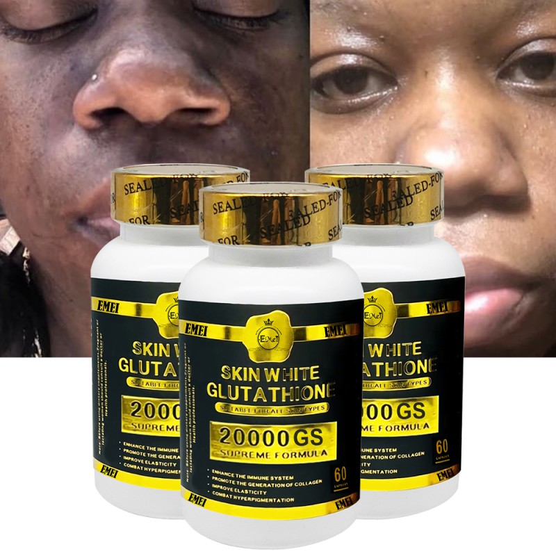 Vitamin C Capsule Factory - Skin Whitening Anti Aging Supplement