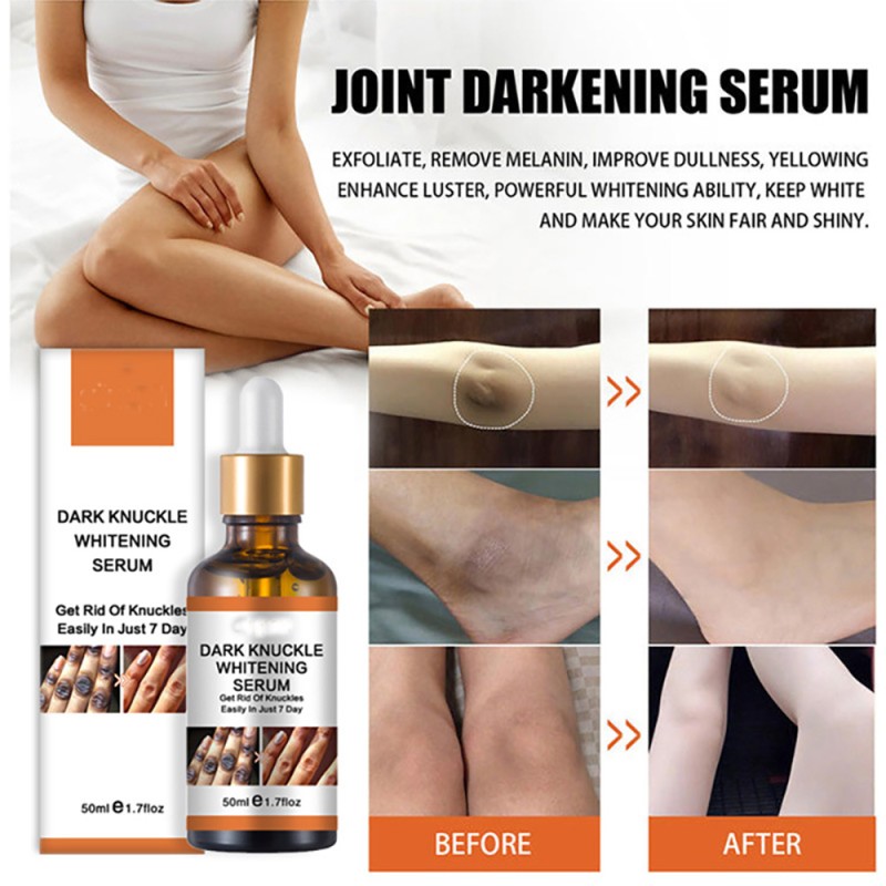 Skin Lightening Oil Supplier - Private Label Dark Knees Elbows