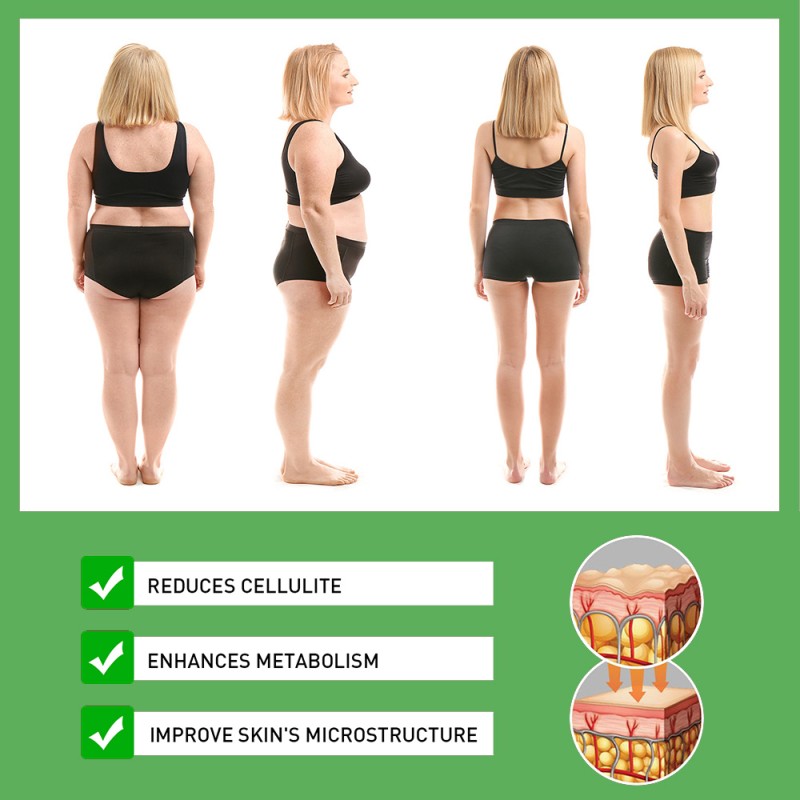 Herbal Slimming Cream Supplier - 2024 Best Selling Ginger Tummy