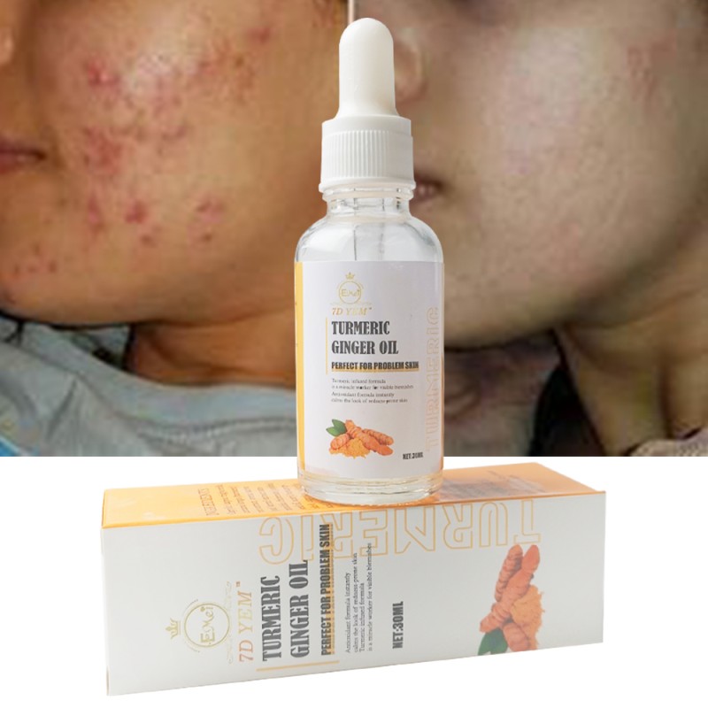 Ginger Essential Oil Supplier - 30ml Firming Skin Rejuvenates