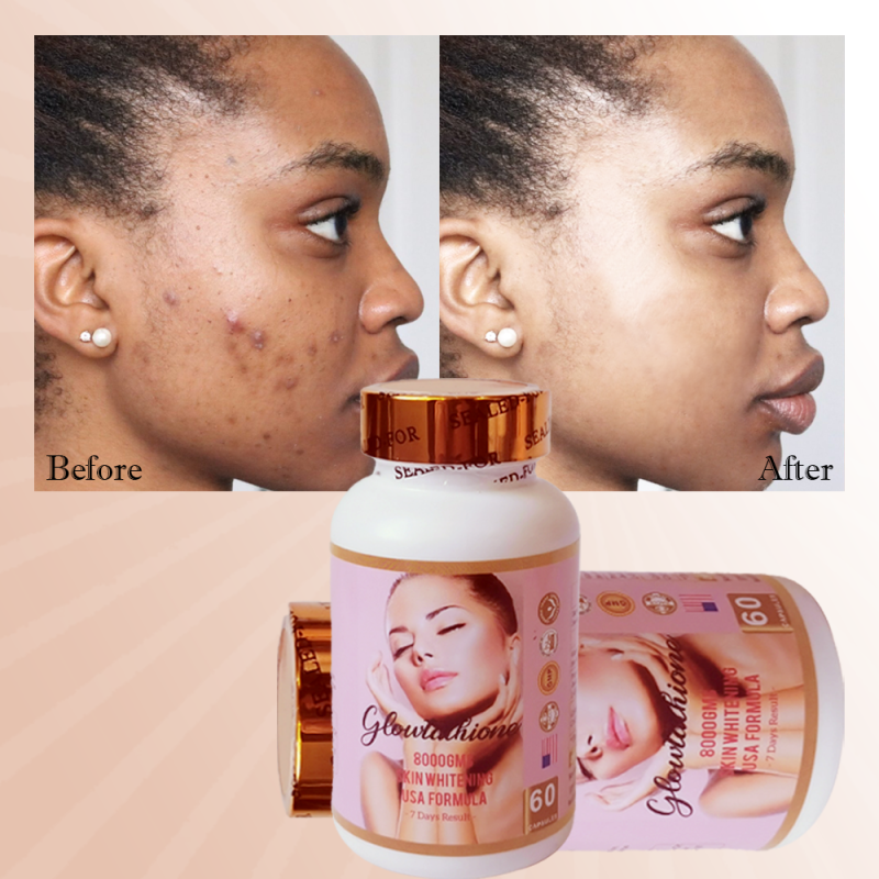 Skin Whitening Capsules Manufacturer - Glutathione Anti-Aging Collagen