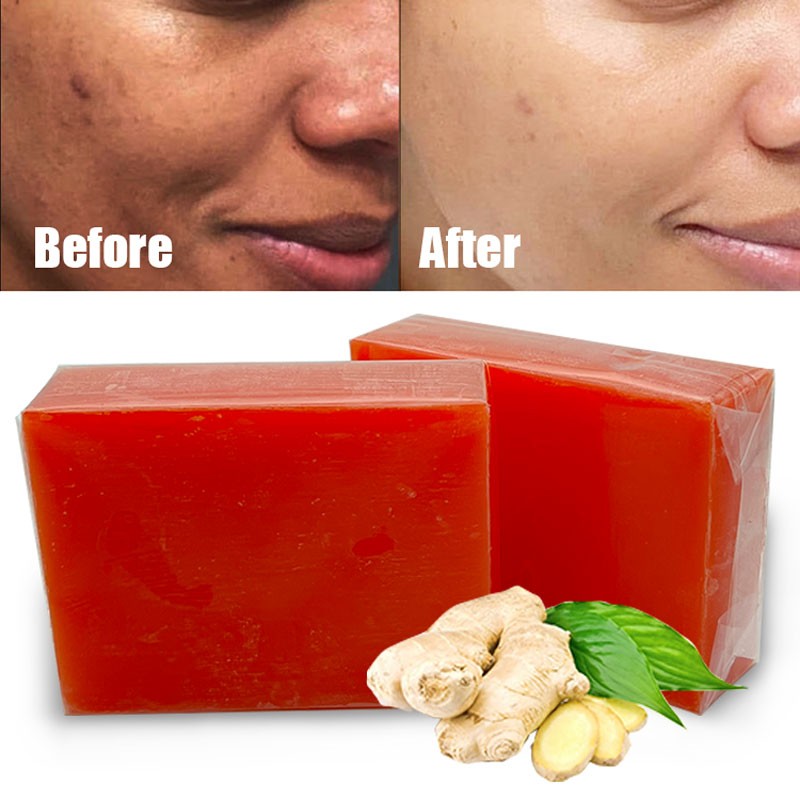 Toilet Soap Supplier - Manufacturing Anti Acne Dark Spots