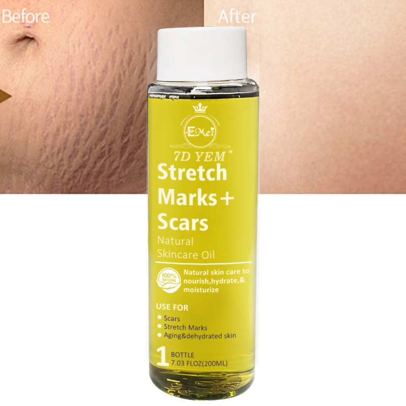 Stretch Marks Oil Supplier - Natural Ingredients Body Peeling