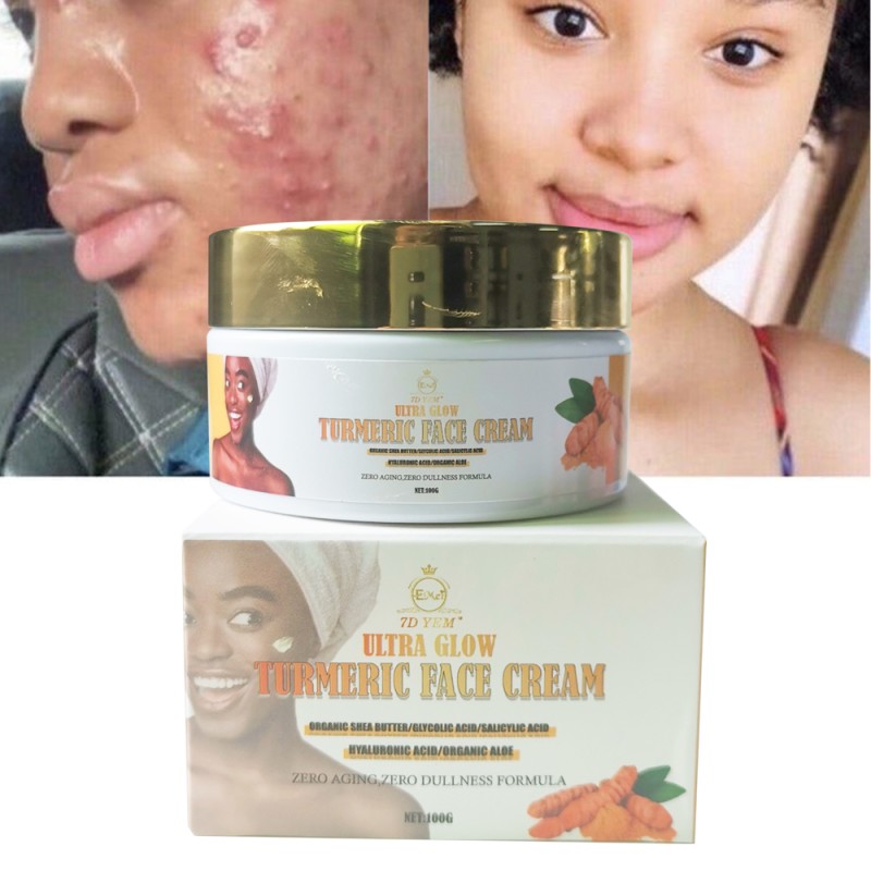 Face Cream Manufacturer - Turmeric Acne Dark Spot Remove Whitening