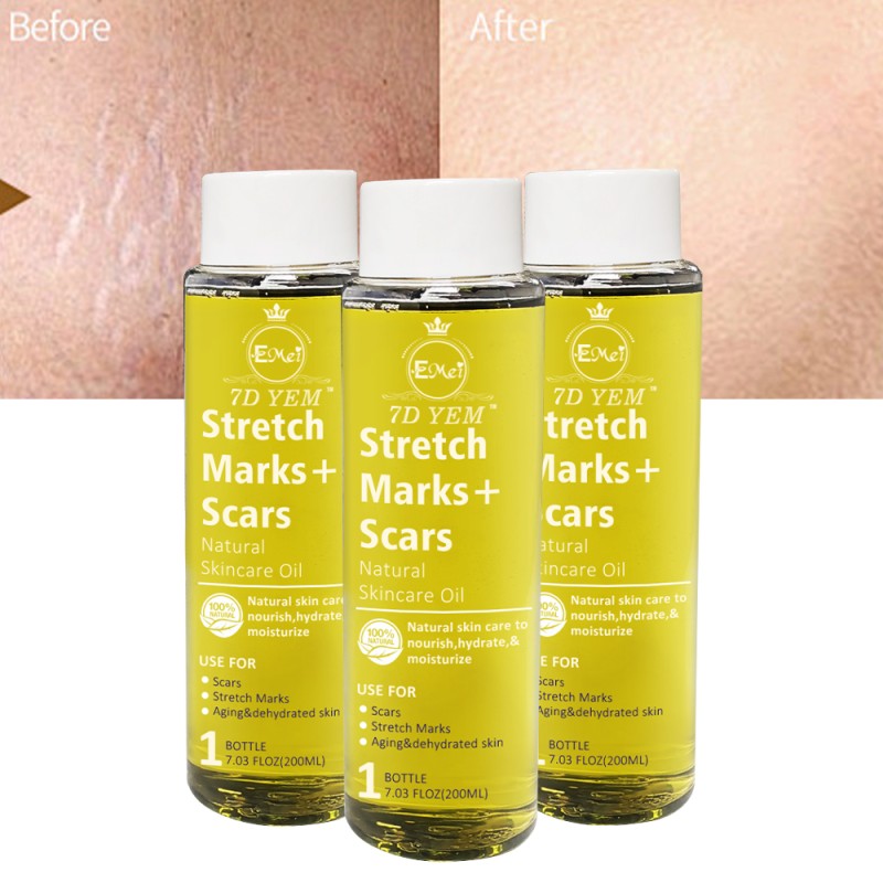Stretch Marks Oil Supplier - Natural Ingredients Body Peeling