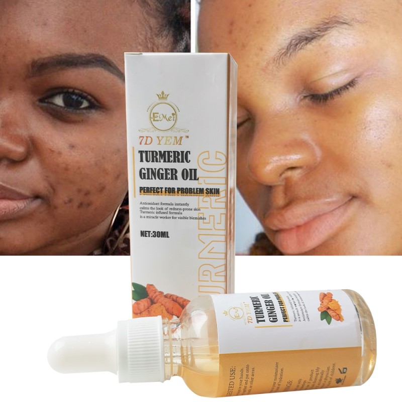 Ginger Essential Oil Supplier - 30ml Firming Skin Rejuvenates