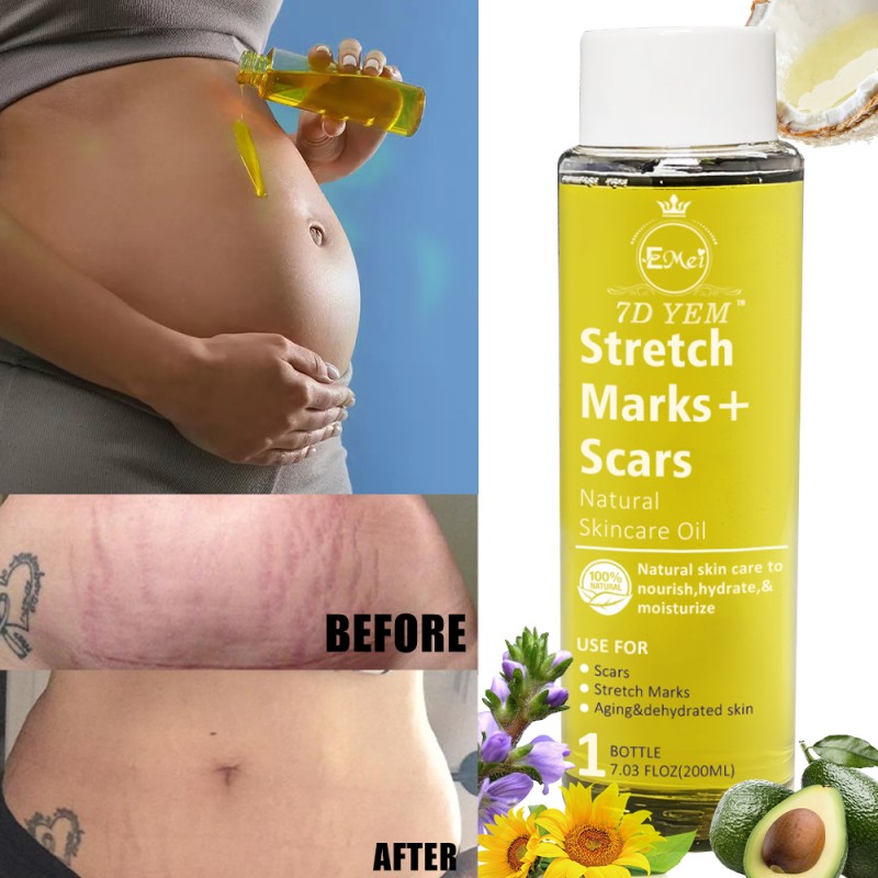 Stretch Marks Oil Supplier - Natural Ingredients Body Peeling