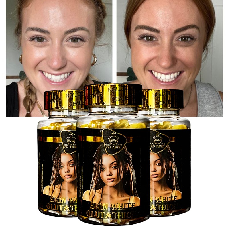 Whitening Skin Capsule Supplier - Best Selling Private Label OEM