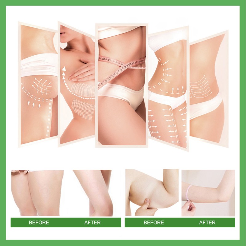 Fat Burning Cream Factory - Private Label Turmeric Loss Weight