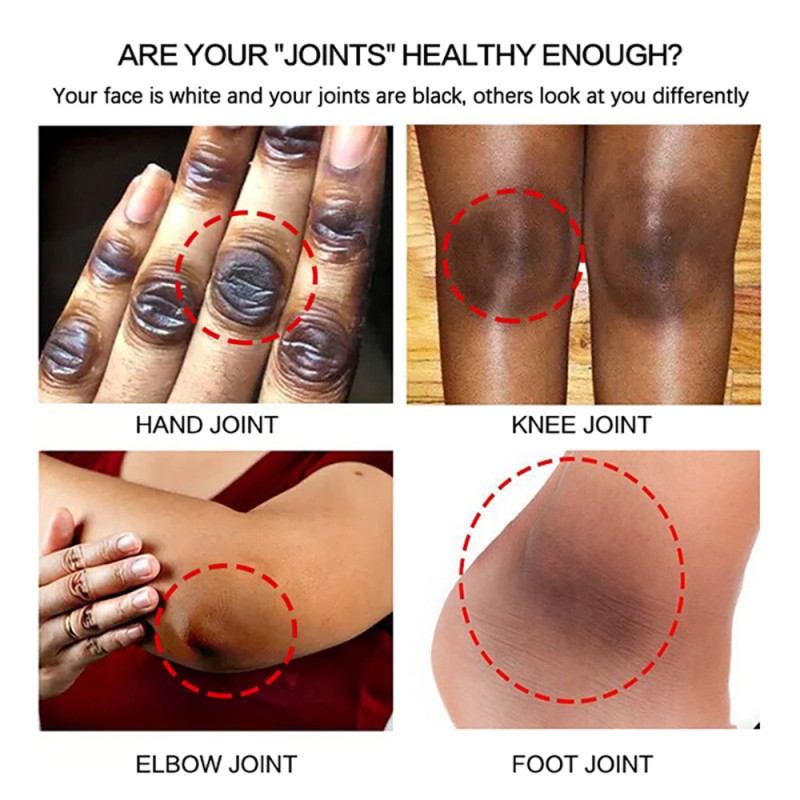 Skin Lightening Oil Supplier - Private Label Dark Knees Elbows