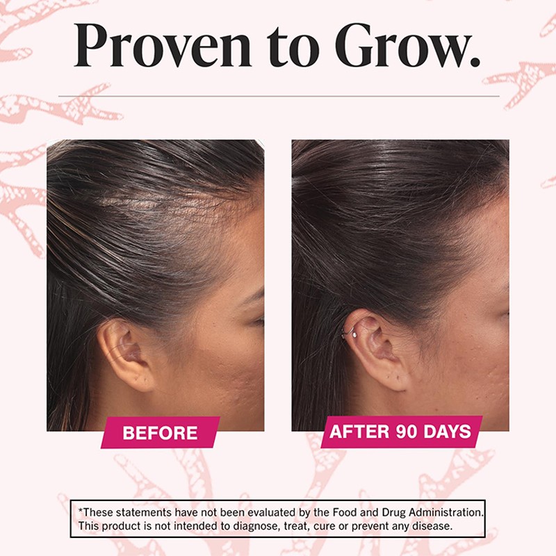 Hair Growth Tablets Manufacturer - OEM ODM Private Label Biotin