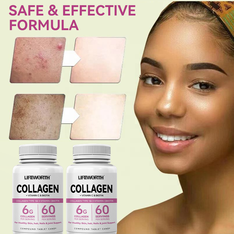 LIFEWORTH Advanced Collagen Tablets Supplements for Hair Skin Nail Health and Joint Support