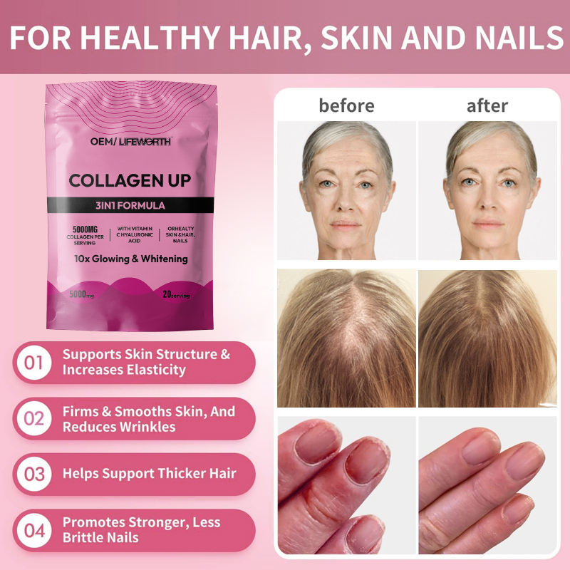 LIFEWORTH Vitamin C Multi Marine Fish Collagen Peptides Powder Hydrolyzed for Skin Whitening