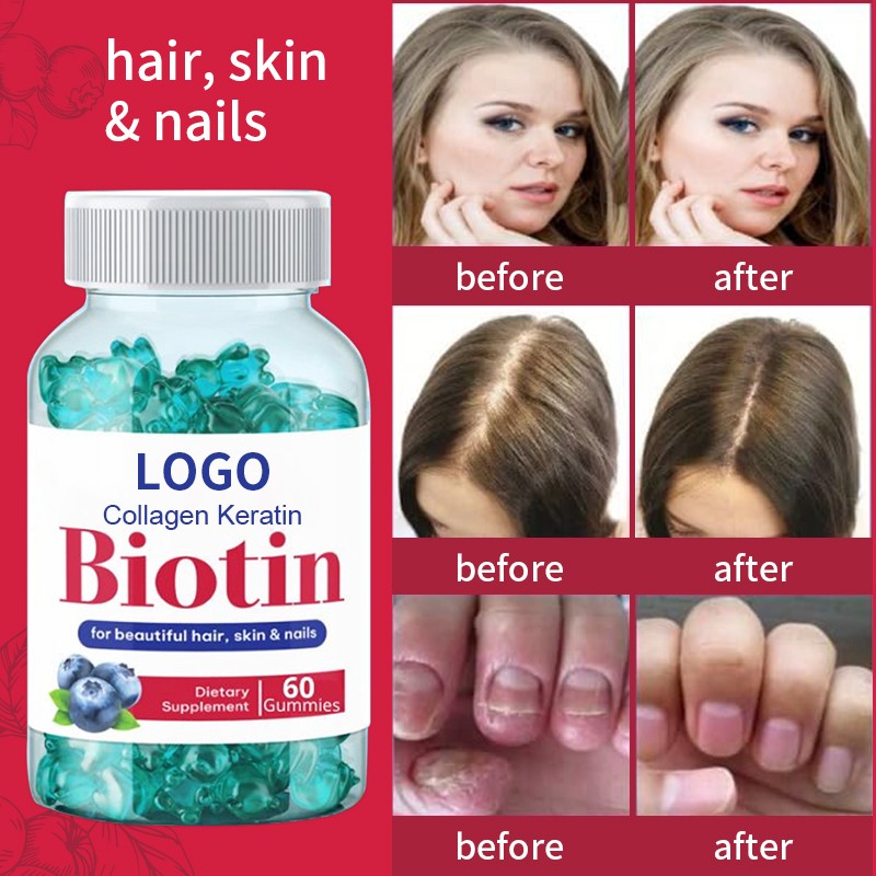 Collagen Gummies Manufacturer - Wholesale Hydrolyzed with Vitamin C Biotin