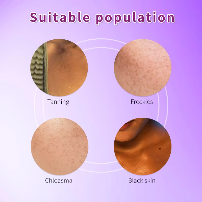 Grape Seed Capsules Supplier - OEM Antioxidant Vitamin Complex