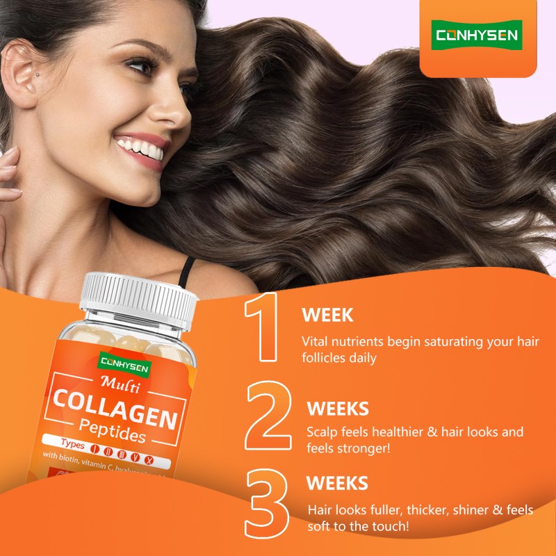 Collagen Softgel Supplier - OEM Multi Peptides Vitamin C Joint Pains