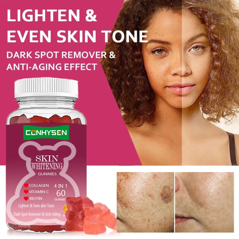 Skin Whitening Gummies Supplier - Best Lightening Even Tone Biotin Collagen