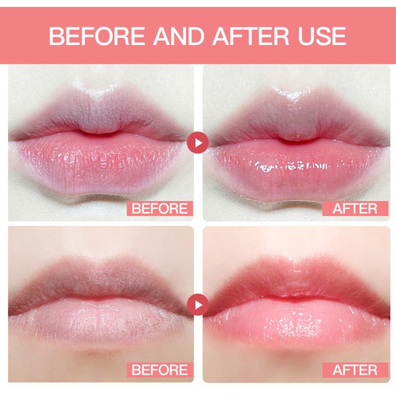 Lip Sleeping Mask Supplier - OEM Vitamin C Moisturizing Balm