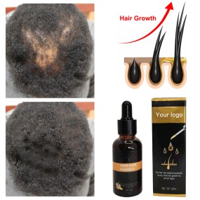 Hair Growth Oil Factory - OEM Smoothing Repairing Scalp